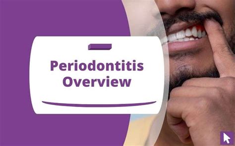 Periodontitis Overview Symptoms Causes And Treatments