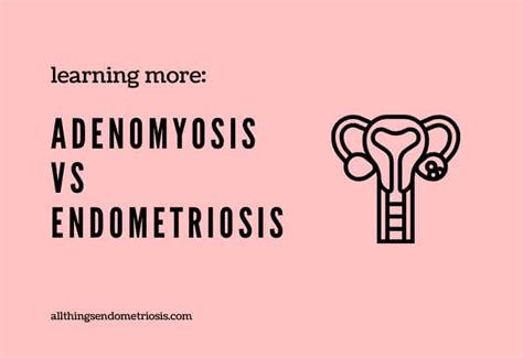 This is especially true for human beings. Adenomyosis vs Endometriosis - All Things Endometriosis ...