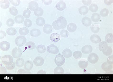 Plasmodium Falciparum Ring High Resolution Stock Photography And Images