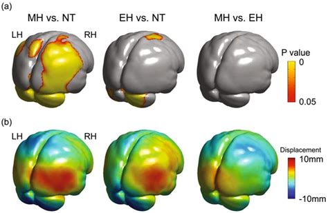 Comparisons Of The Brain Surface Morphology Among Neanderthal Early Download Scientific