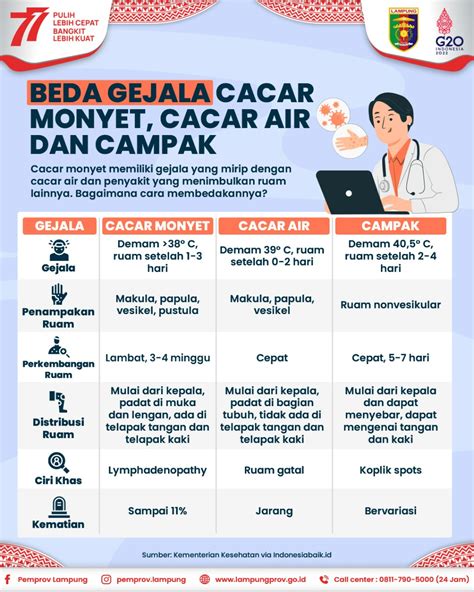 Beda Gejala Cacar Monyet Cacar Air Dan Campak Ppid Provinsi Lampung