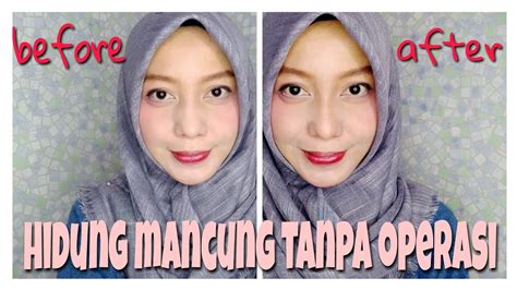 Cara Memancungkan Hidung Tanpa Operasi Aman Banget Youtube