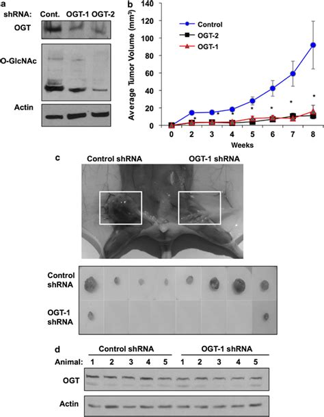Ogt Is Required For Tumorigenic Growth Of Human Breast Cancer Cells In