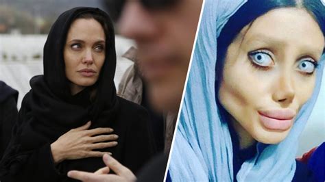 19 Year Old Girl Got 50 Surgeries To Look Like Angelina Jolie Now