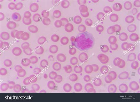 Monocyte Blood Smear Under Microscopy Stock Photo Edit Now 1114287713
