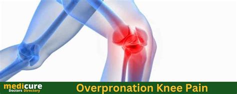 Overpronation Knee Pain Causes Treatment Medicure