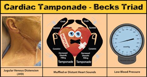 Asmokeythebear “becks Triadsimple But Can Save Lives In Ems