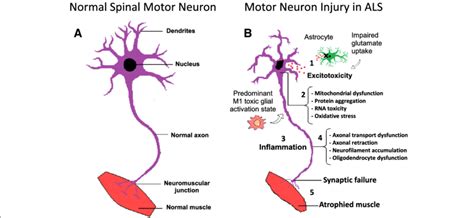 Molecular Mechanisms In The Pathology Of Amyotrophic Lateral Sclerosis