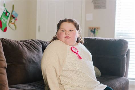 Docs Forced To Alter Surgery Plans For Obese Girl Nbc News