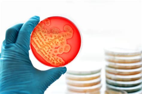 Best Klebsiella Pneumoniae Stock Photos Pictures And Royalty Free Images