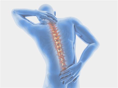 Arthritis Symptoms Of The Spine And How To Treat Them London