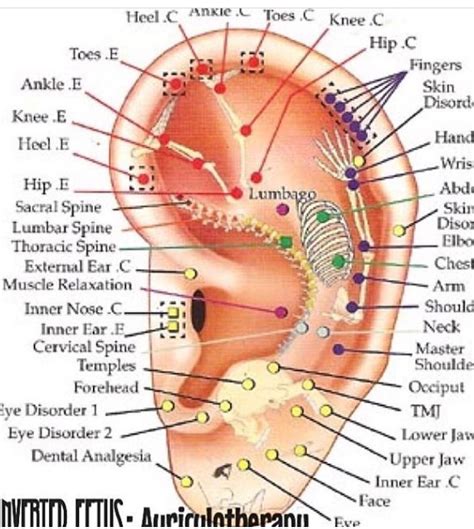 Pinterest Ear Reflexology Piercing For Migraine Relief Acupuncture
