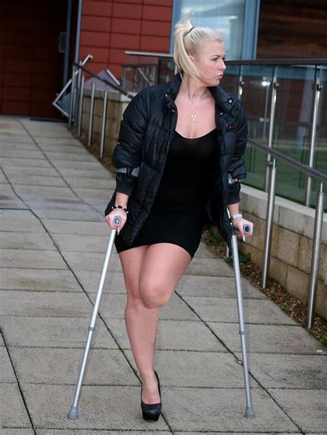 Leg Amputee Women Prosthetics
