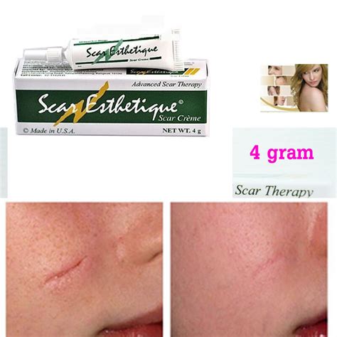 2x Scar Esthetique Cream Advanced Scar Therapy Treatment Burns Keloid
