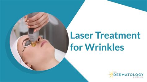 Laser Treatment For Wrinkles Removal Youtube