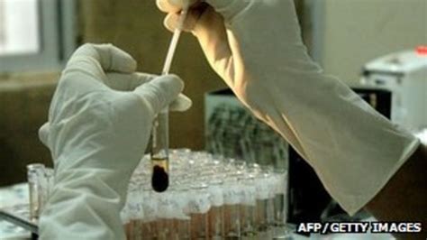 20 Of New Hiv Cases In Northern Ireland Are Men Over 45 Bbc News