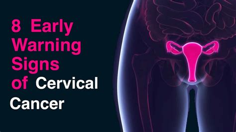 Goals of cervical cancer screening. 8 Early Warning Signs of Cervical Cancer