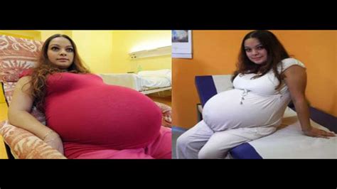 Quintuplets Pregnancy