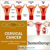 Pictures of Cervical Cancer During Pregnancy Treatment