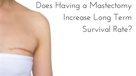 Does Having A Mastectomy Increase Long Term Survival Rate Youtube