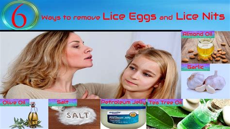 6 Ways To Remove Lice Eggs And Lice Nits Home Remedies To Remove Lice