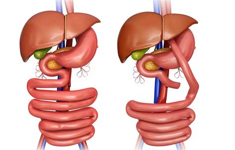 The Meaning Of Surgical Anastomosis