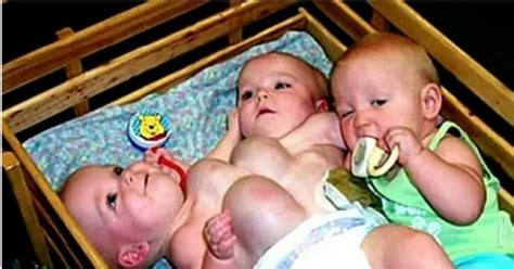 This Unusual Set Of Conjoined Triplets Earned International Fame
