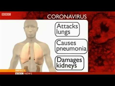 How can i protect myself? coronavirus symptoms - YouTube