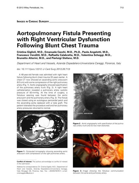 PDF Aortopulmonary Fistula Presenting With Right Ventricular