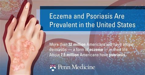 Eczema Vs Psoriasis Similarities Differences And Treatments Penn