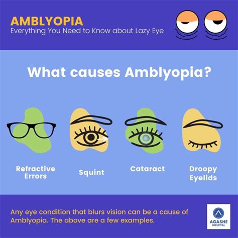 Amblyopia Agashe Hospital