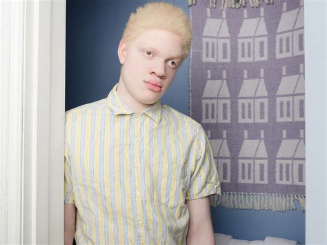 Amazing Pictures Putting The Spotlight On Albinism And Their Beautiful And Unique Features