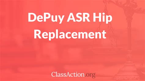 Depuy Asr Hip Replacement Lawsuit