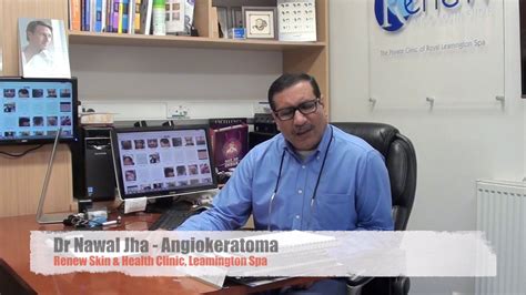 Angiokeratoma Removal Treatment Uk Youtube