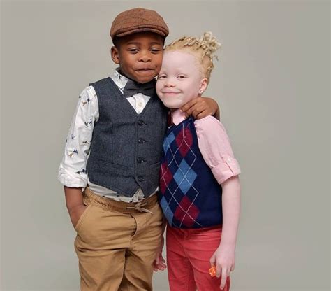 Twins With Different Skin Colors Astonished Their Mom When They Were