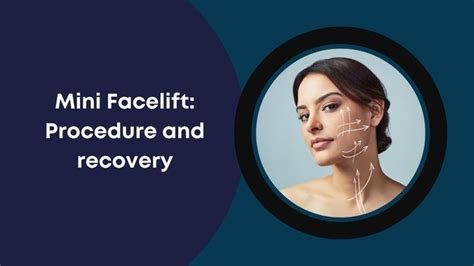 Mini Facelift Procedure And Recovery In 2023 Face Lift Surgery