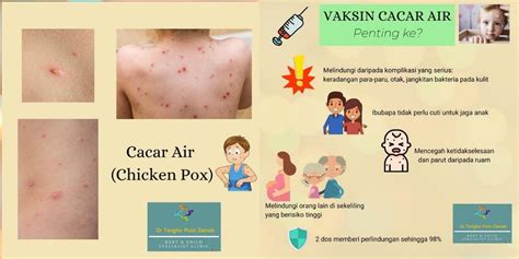 The disease results in a characteristic skin rash that forms small. Ambilah Vaksin Cacar Air (Chicken Pox), Penting! 2 Dos ...
