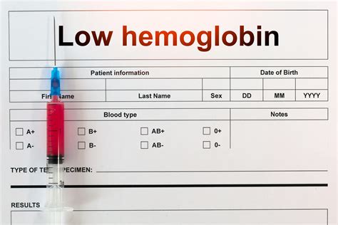 Can Cirrhosis Cause Low Hematocrit And Hemoglobin Ghdelta