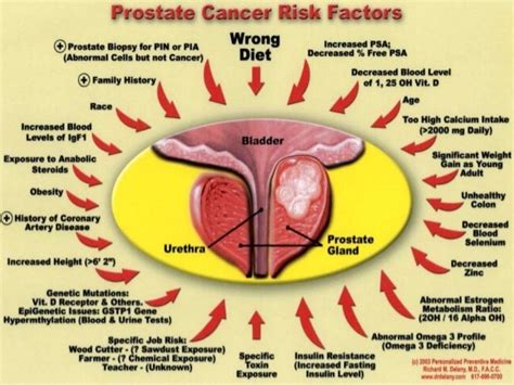 Presentation1pptx Radiological Imaging Of Prostatic Diseases