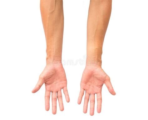 Man Arm With Blood Veins On White Background Health Care And Me Stock