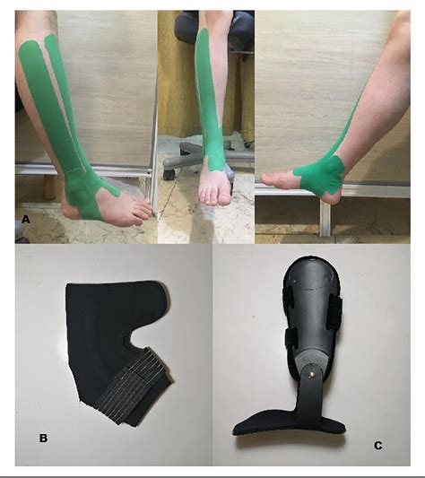 Figure 1 From Effects Of Kinesiotape Vs Soft And Semirigid Ankle