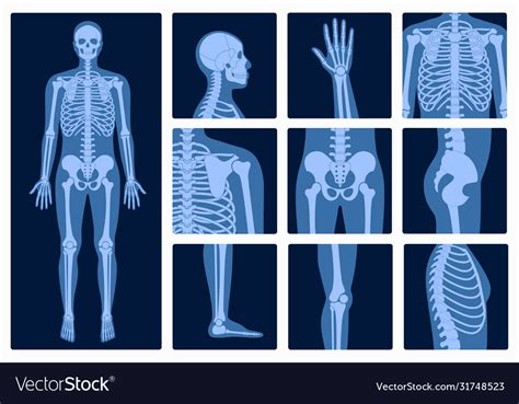 Skeleton X Ray Royalty Free Vector Image Vectorstock