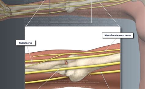 Sensory Branches Of The Ulnar Nerve Trialexhibits Inc Otosection