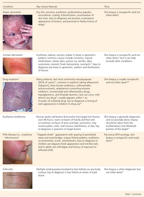 Skin Rash Identification Chart