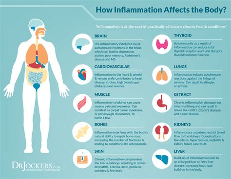 Inflammation Signs You Shouldnt Ignore