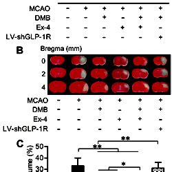 Dmb Treatment Improved Neurological Deficit And Decreased Infarct