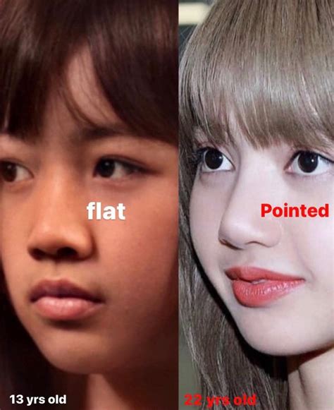 Why Cant Blinks Just Accept That Lisa From Blackpink Has Had Plastic
