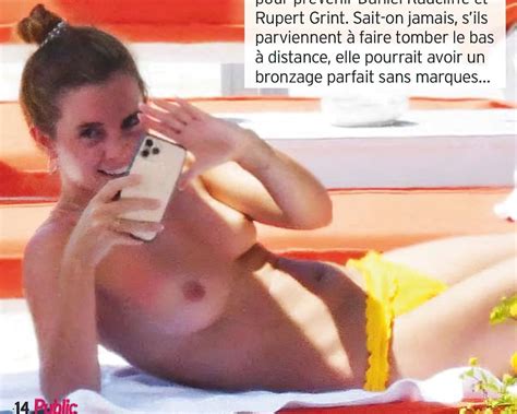 Emma Watson Topless Nude Sunbathing Photos Published In France Hib Com