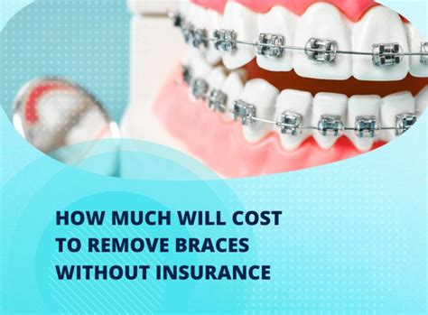 How Much Will Cost To Remove Braces Without Insurance How You Can Reduce Expenses