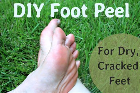 Try this super simple diy mud foot mask recipe that calls for just a few ingredients that will detox your body and leave your feet healthy and soothed! A DIY Peel for Dry, Cracked Feet | Cracked feet, Dry ...